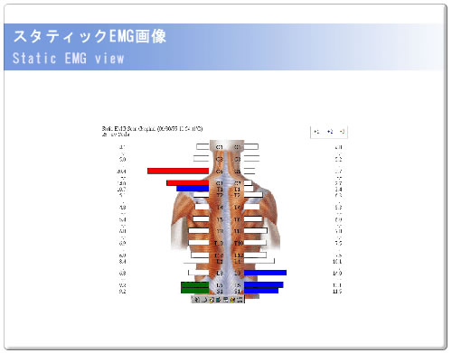 X^eBbNEMG摜