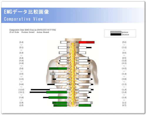 EMGf[^r摜